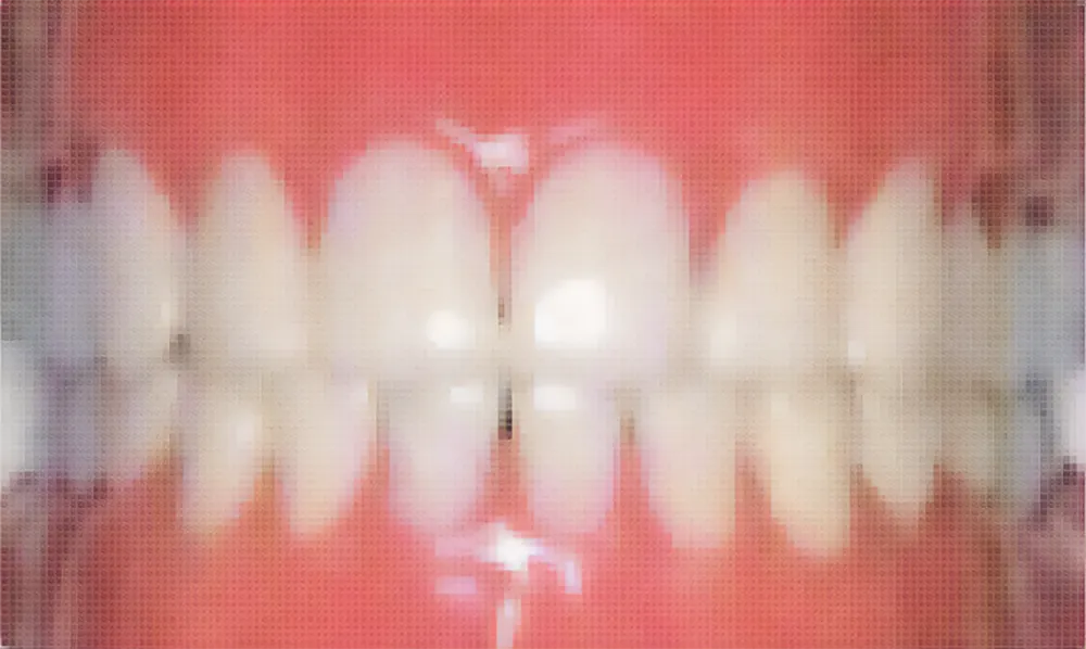 歯周治療
